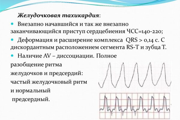 Кракен наркоз магазин